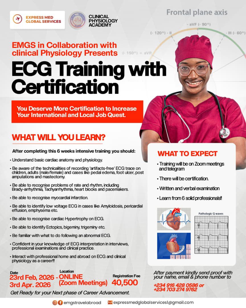 ECG